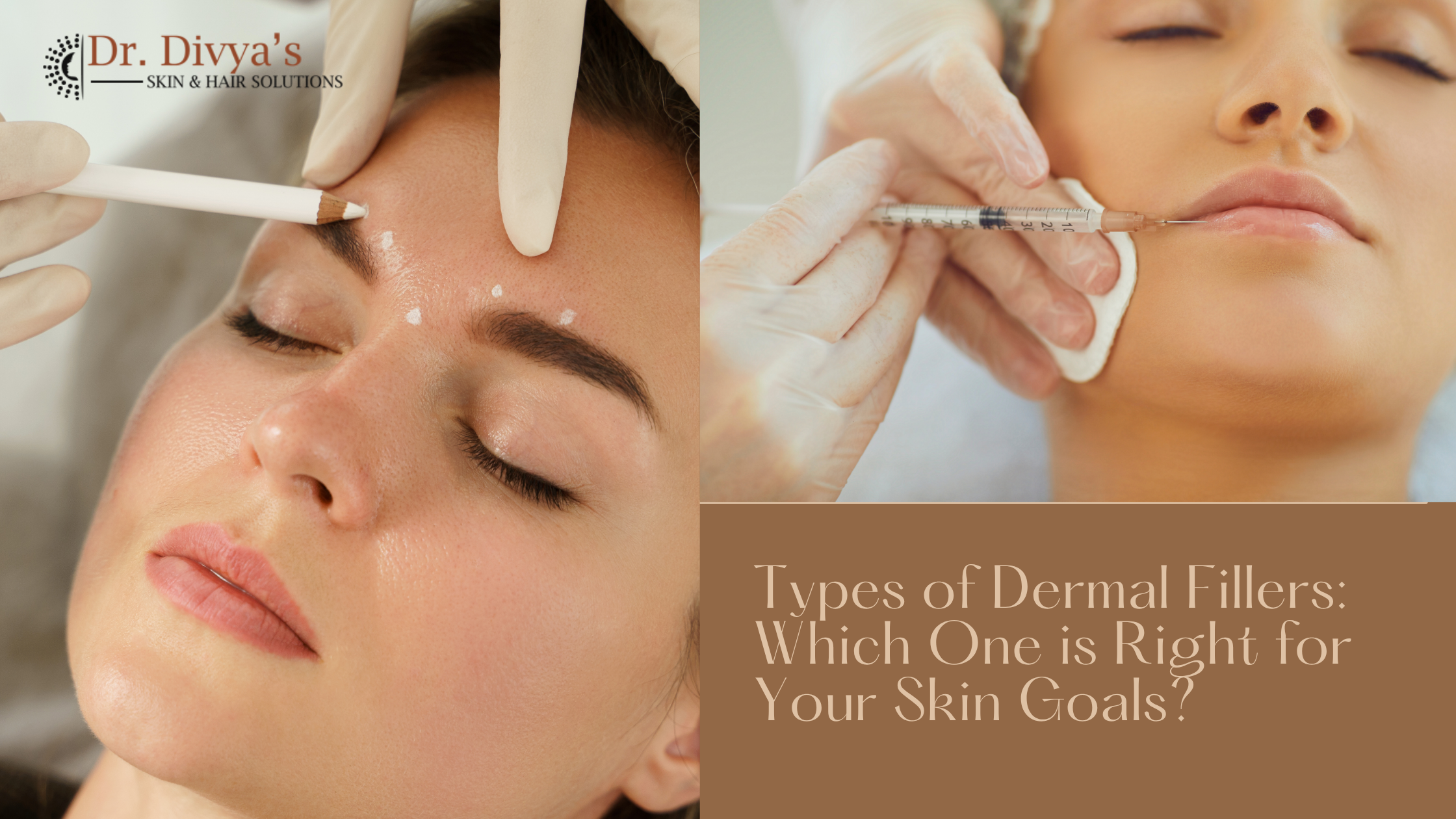 Types of Dermal Fillers