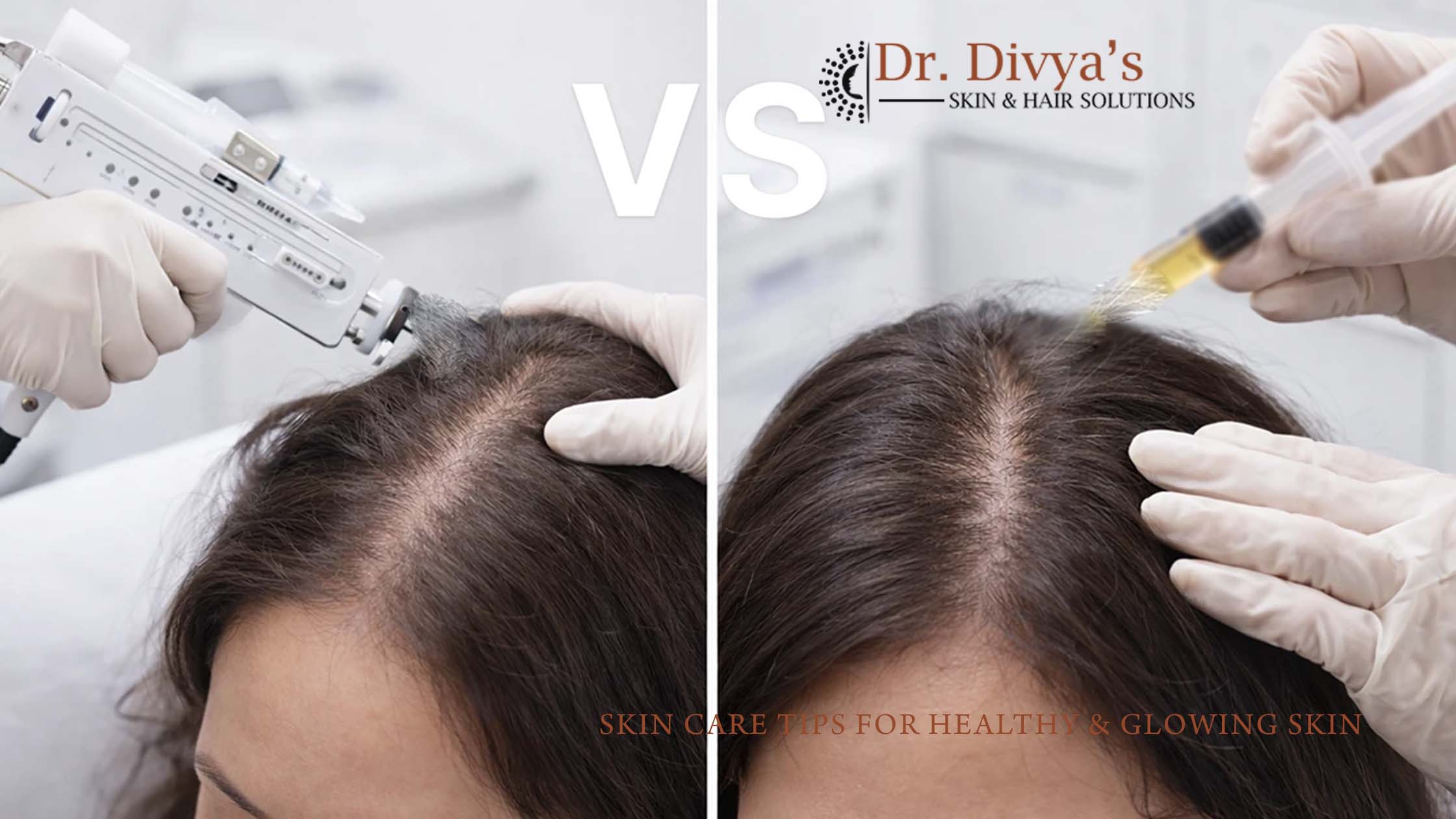Effective Treatments for Hair Fall & Hair Thinning