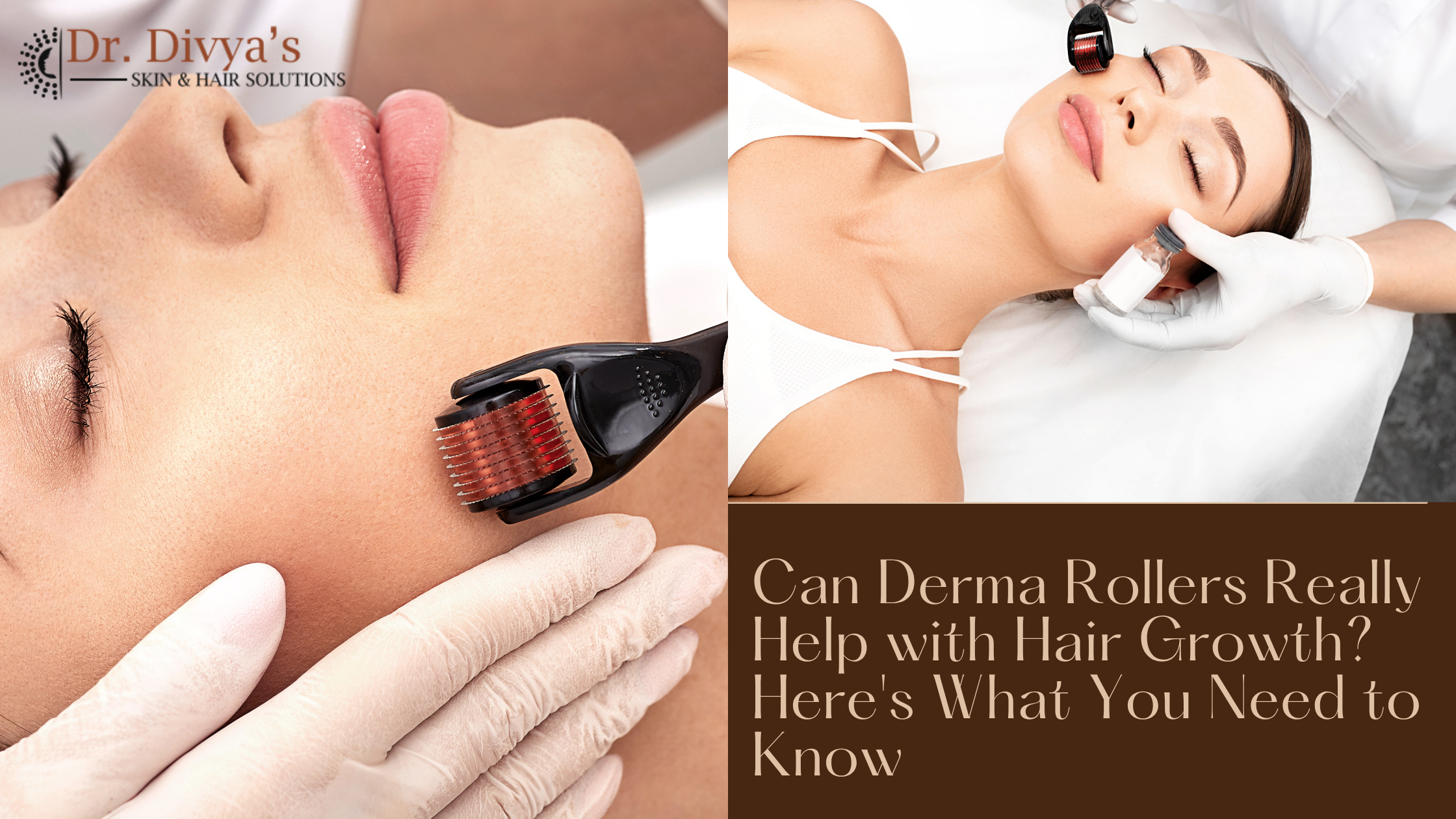 Derma Rollers
