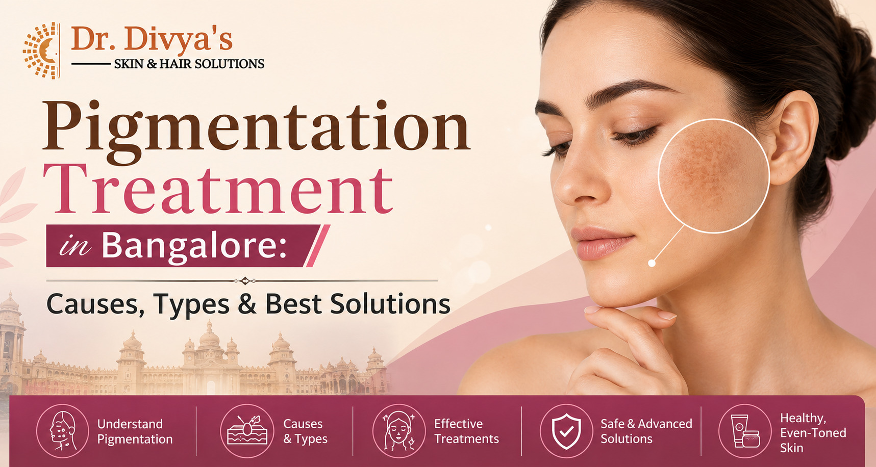 Pigmentation Treatment in Bangalore: Causes, Types & Best Solutions