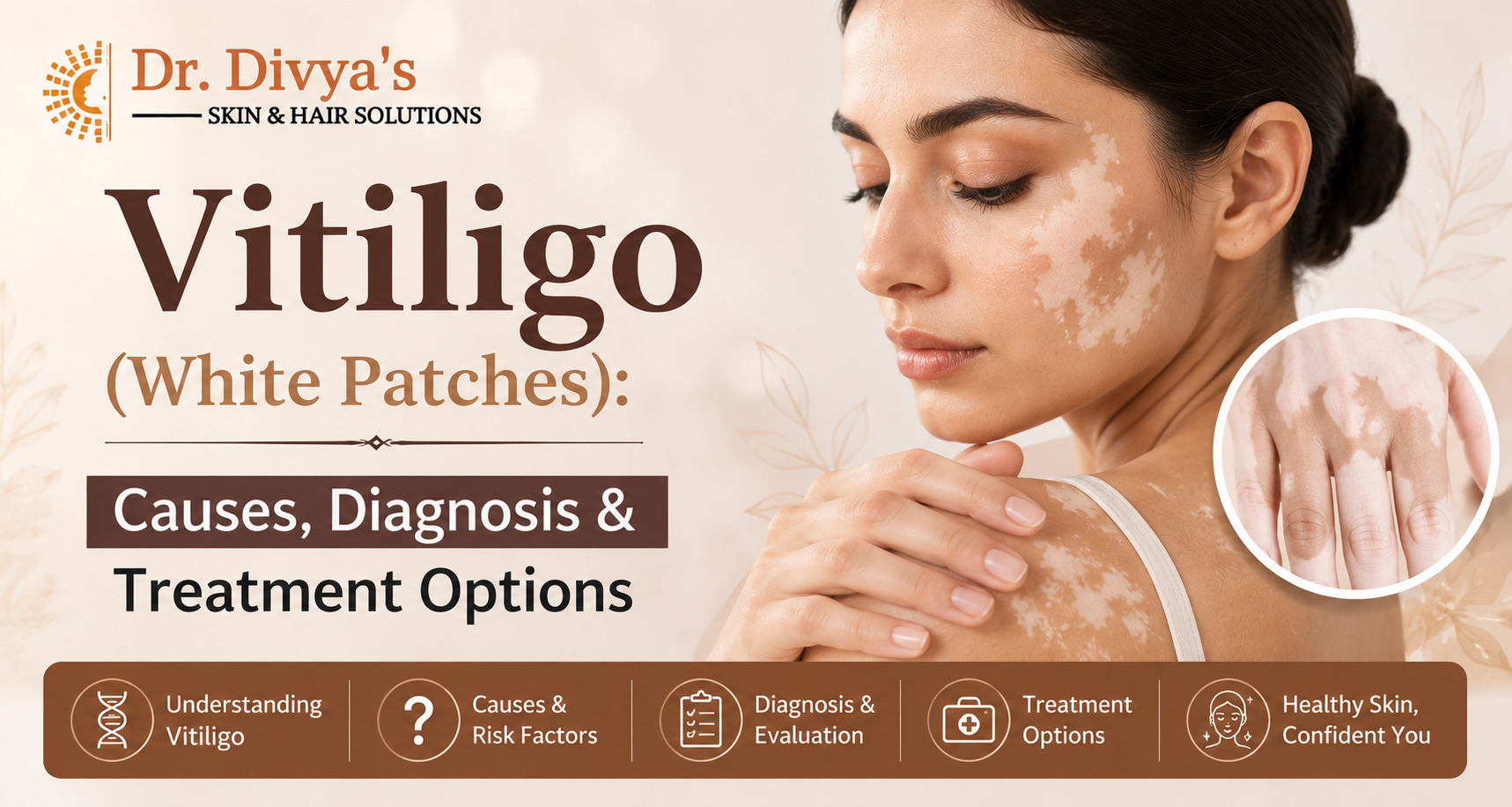 Vitiligo (White Patches): Causes, Diagnosis & Treatment Options