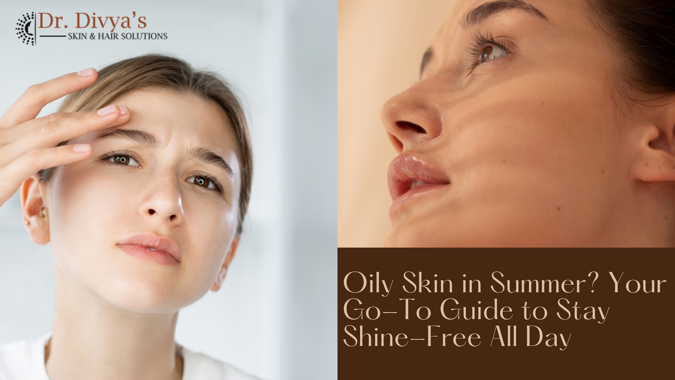 Oily Skin in Summer