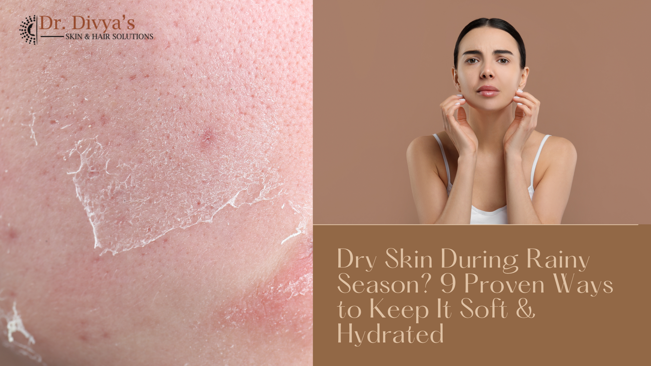 Dry Skin During the Rainy Season
