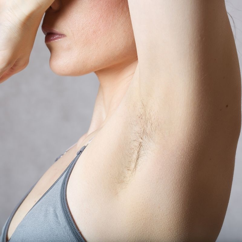 What causes Dark underarms, how to prevent and possible treatments by Dr  Divya Sharma
